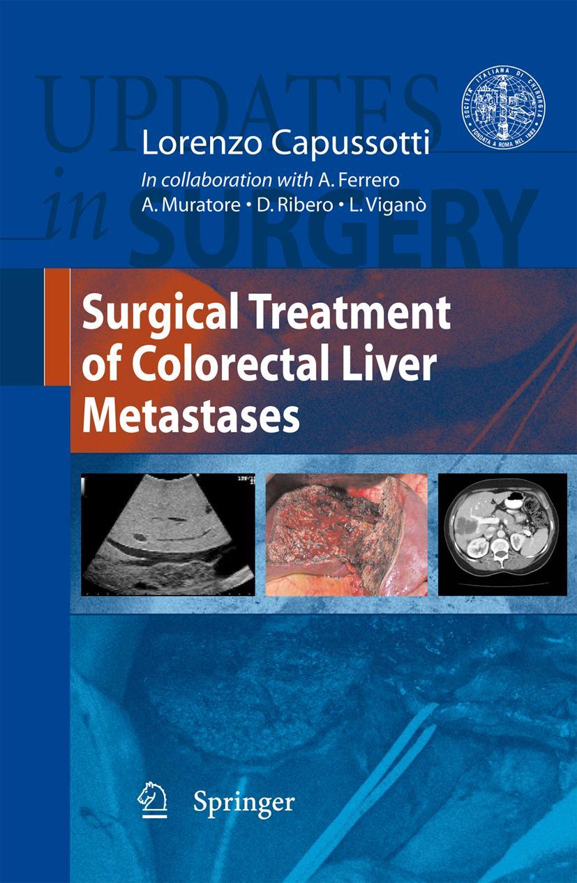Vorderes Coverbild Surgical Treatment of Colorectal Liver Metastases