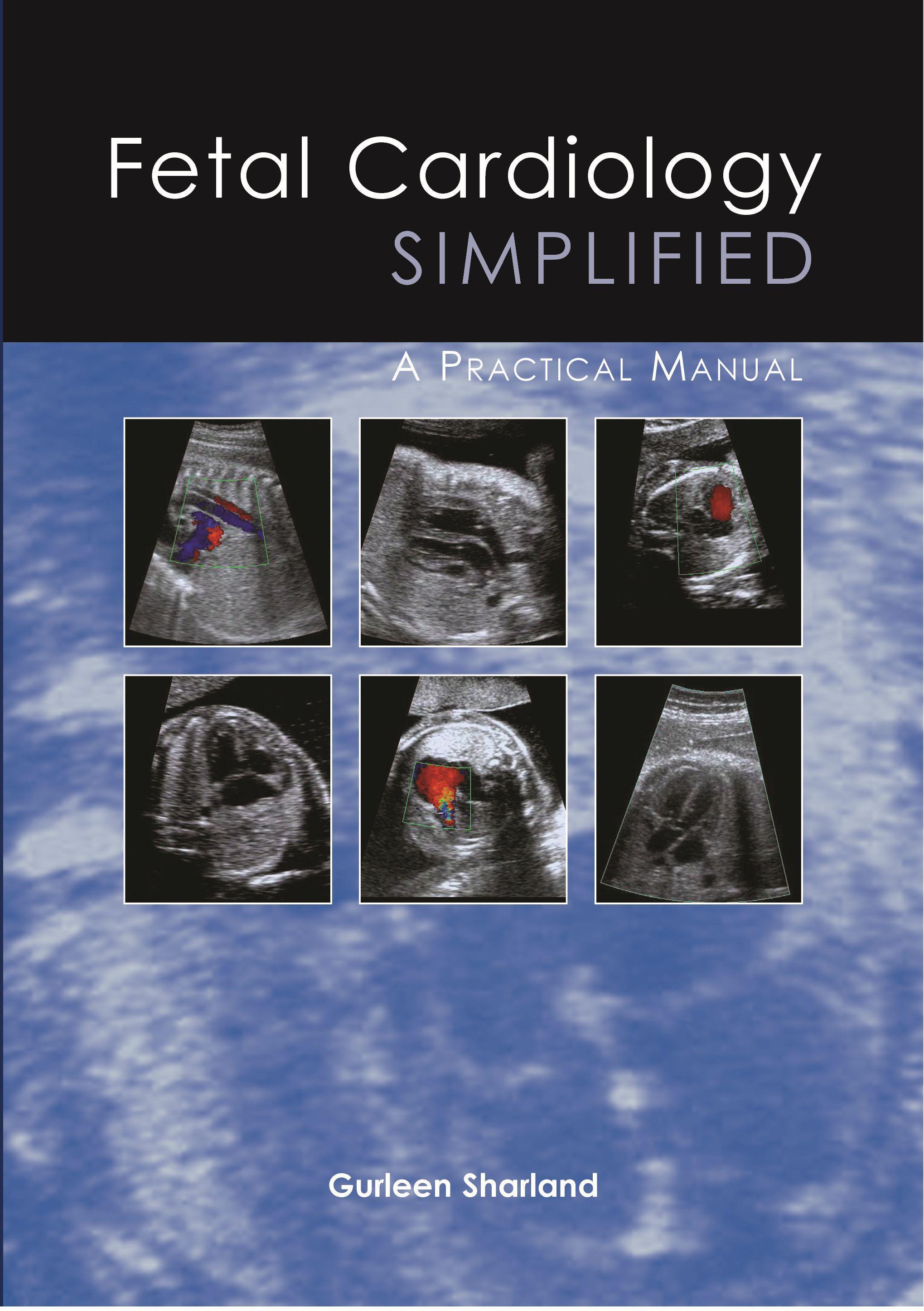 Vorderes Coverbild Fetal Cardiology Simplified