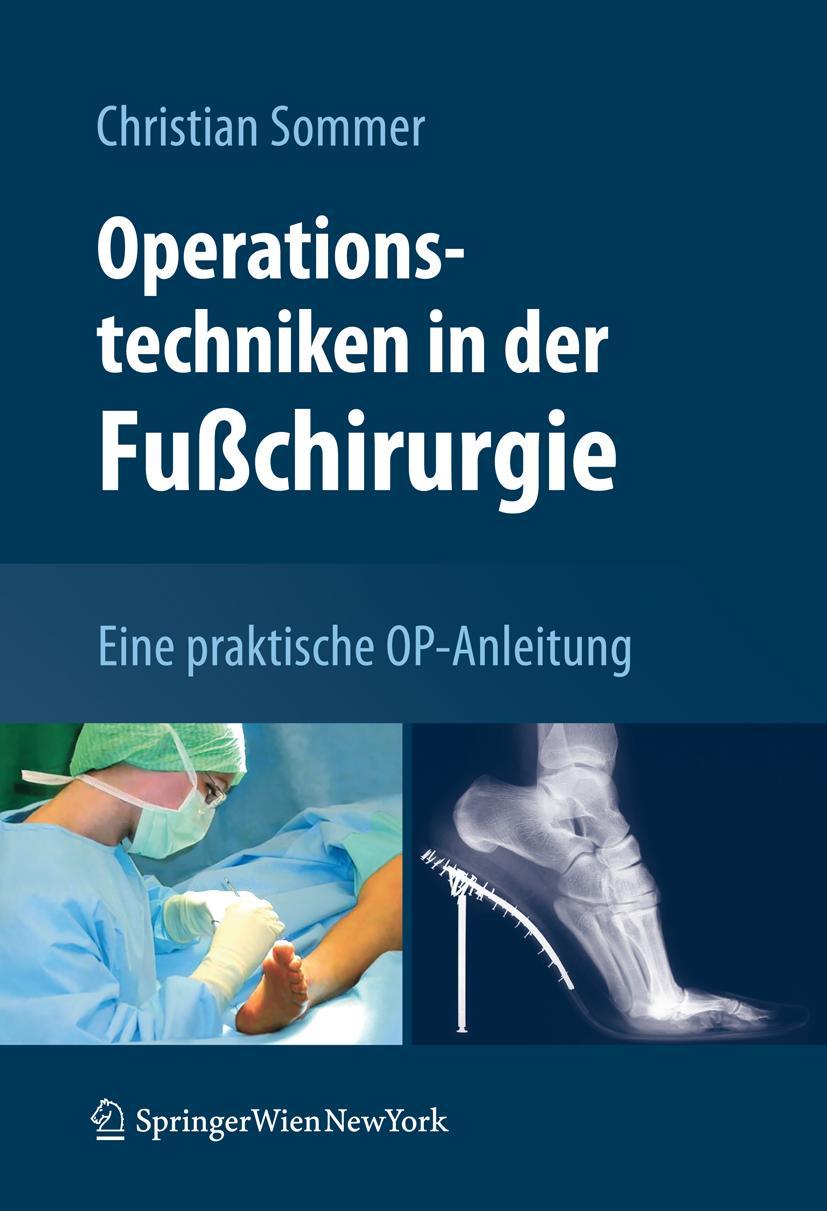 Vorderes Coverbild Operationstechniken in der Fußchirurgie