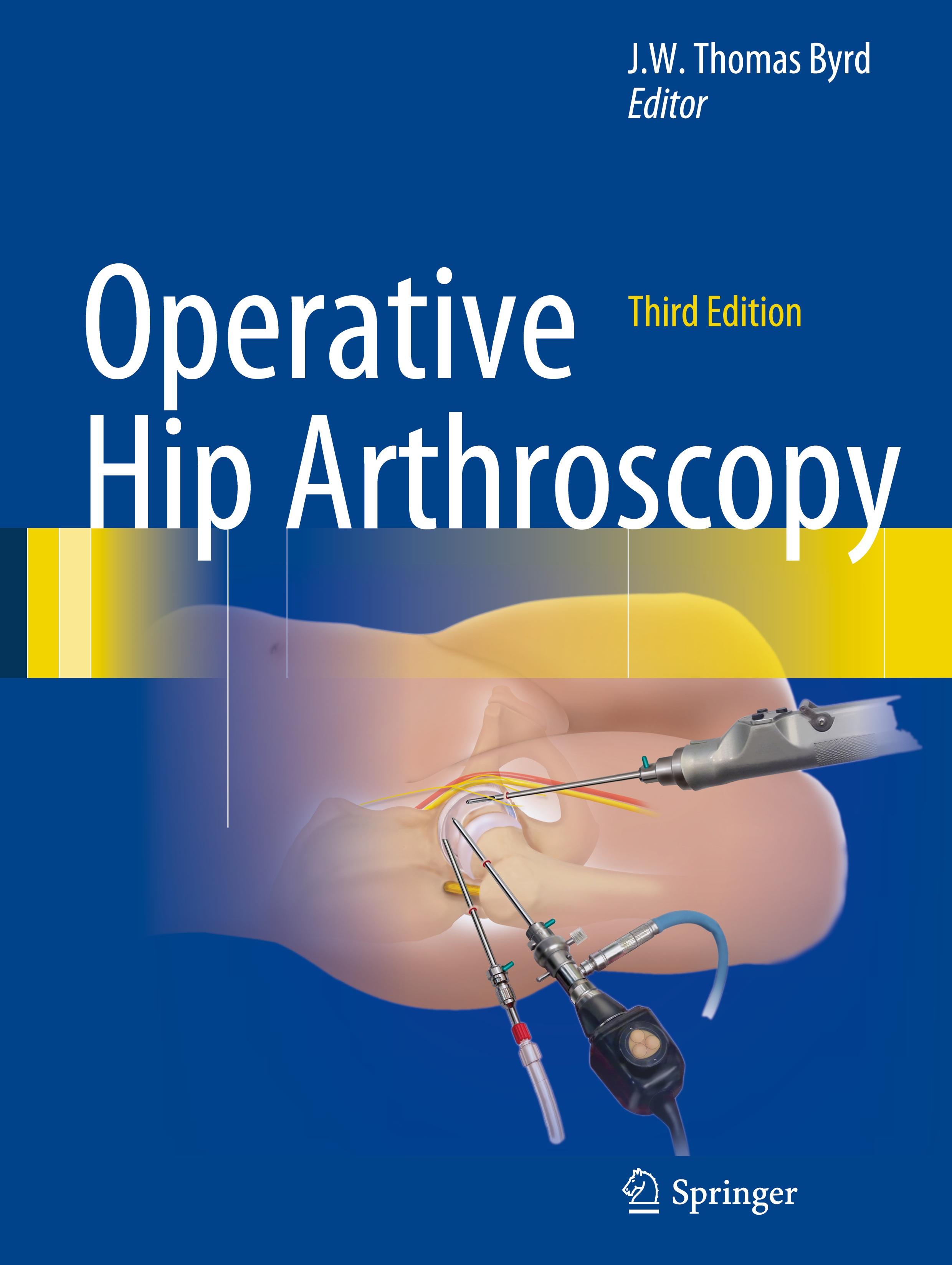 Vorderes Coverbild Operative Hip Arthroscopy