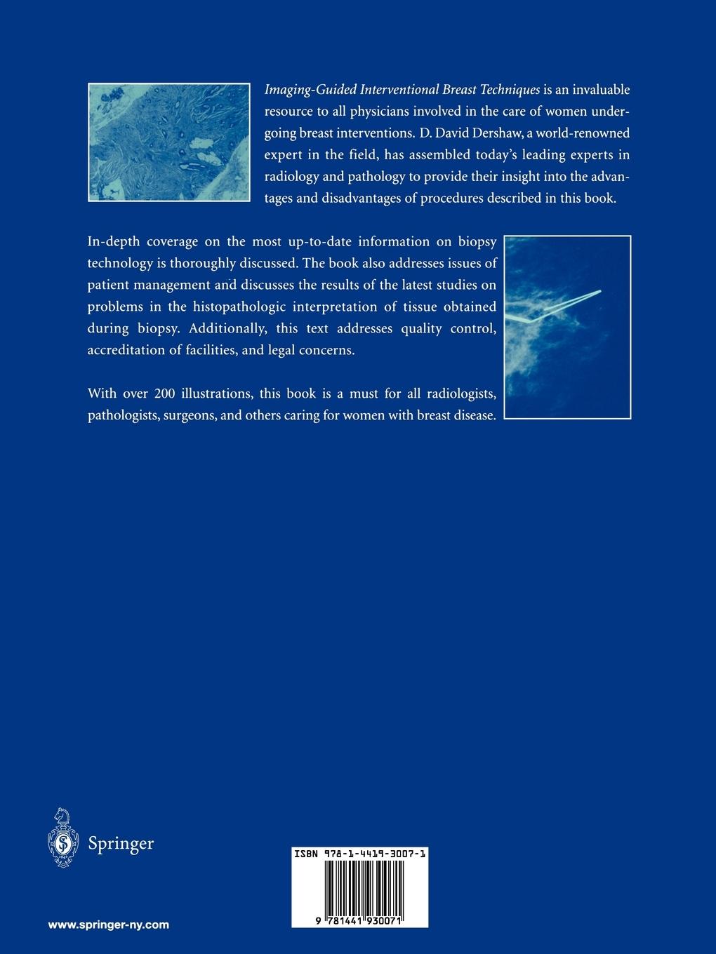 Rückseitencover Imaging-Guided Interventional Breast Techniques