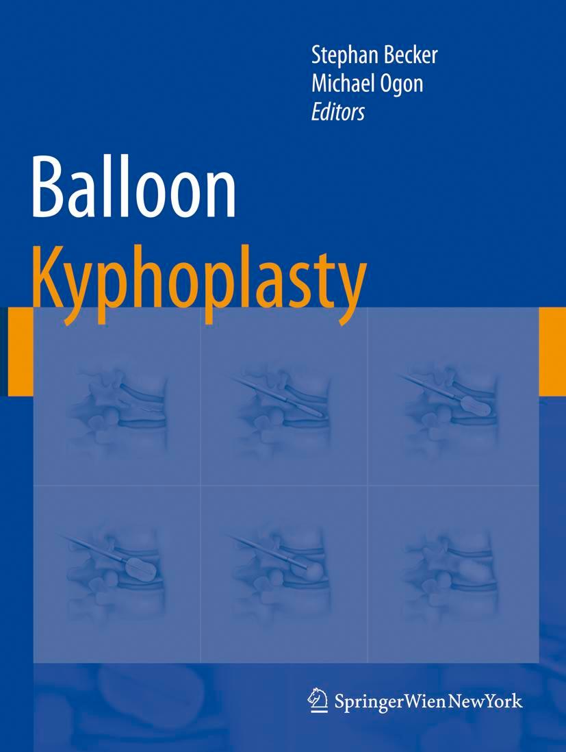 Vorderes Coverbild Balloon Kyphoplasty