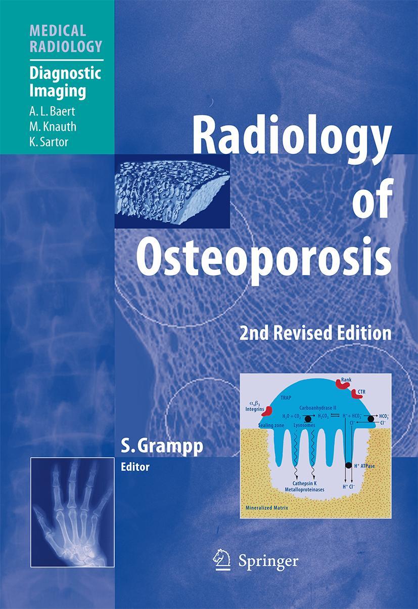 Vorderes Coverbild Radiology of Osteoporosis