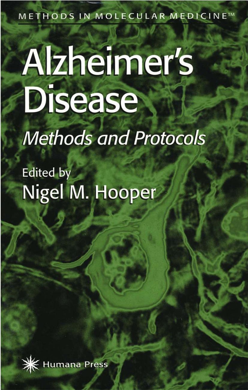 Vorderes Coverbild Alzheimer's Disease