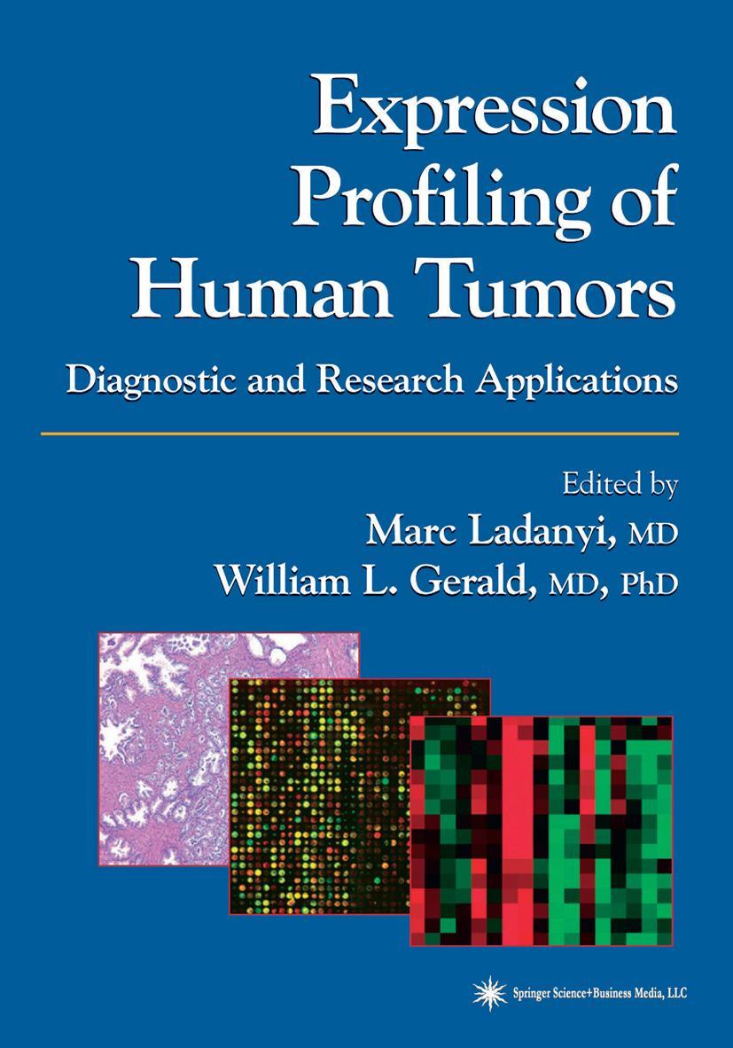 Vorderes Coverbild Expression Profiling of Human Tumors