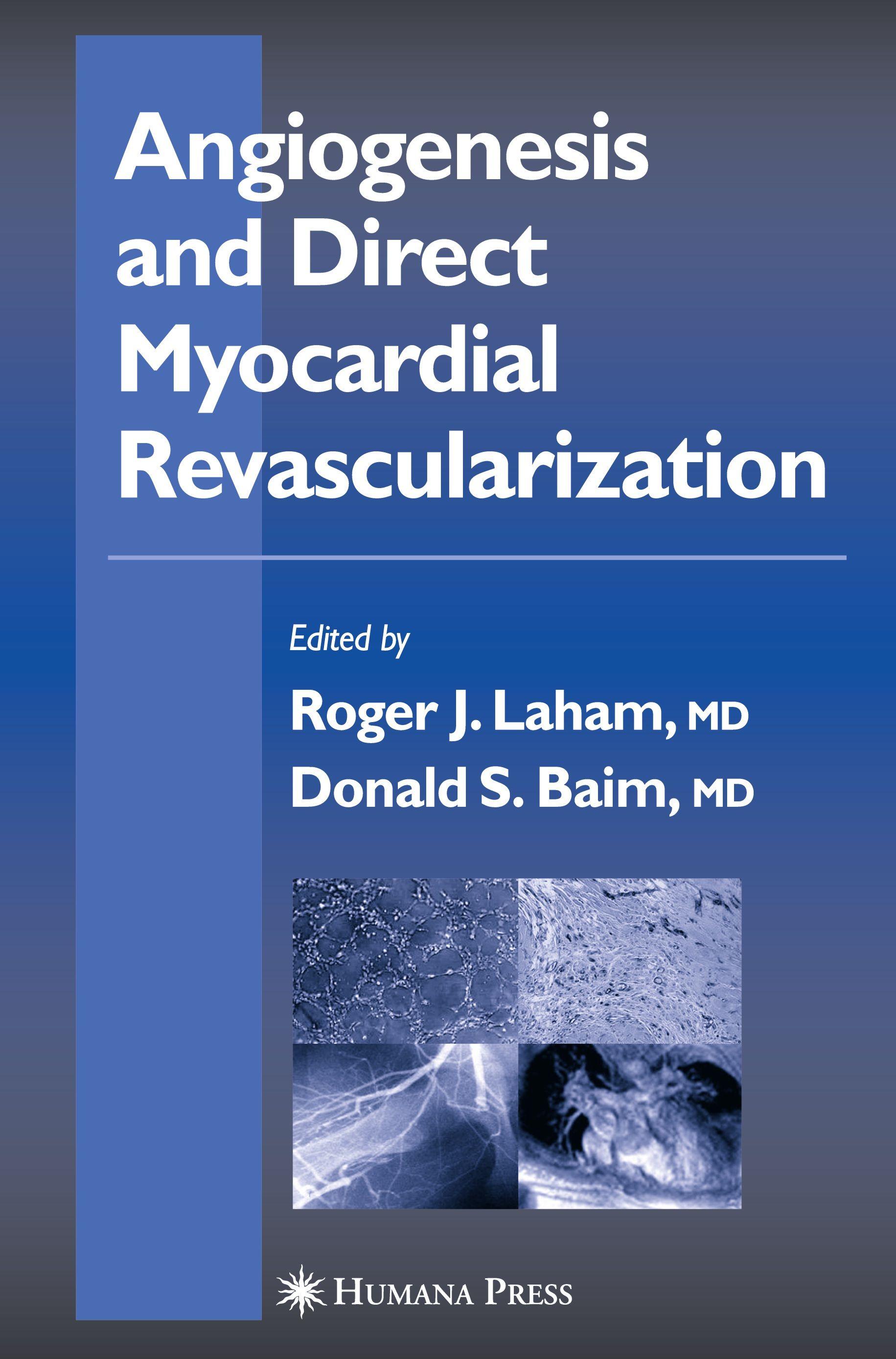 Vorderes Coverbild Angiogenesis and Direct Myocardial Revascularization