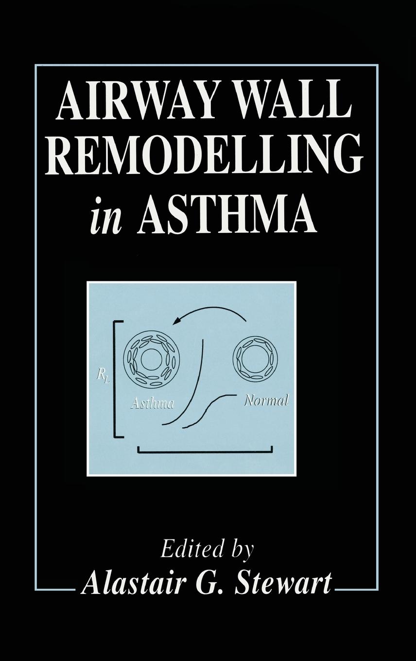 Vorderes Coverbild Airway Wall Remodelling in Asthma