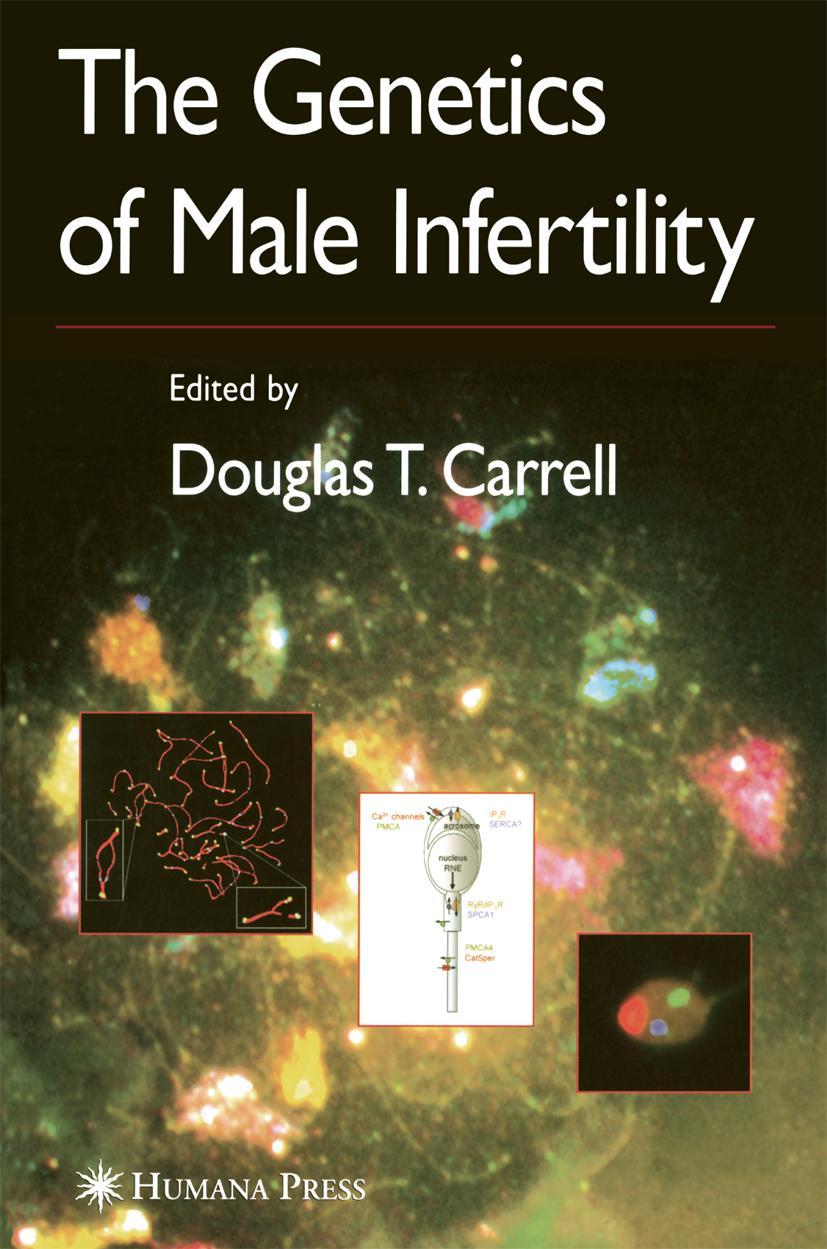 Vorderes Coverbild The Genetics of Male Infertility