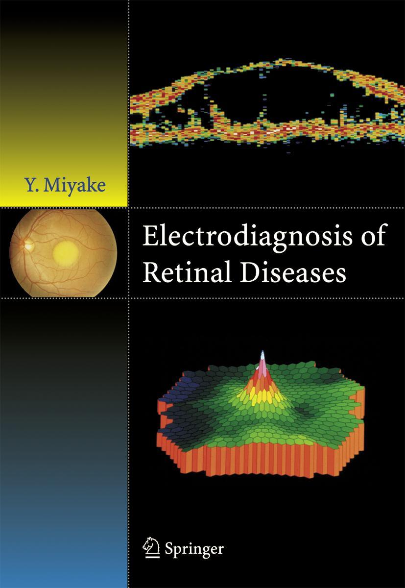 Vorderes Coverbild Electrodiagnosis of Retinal Disease