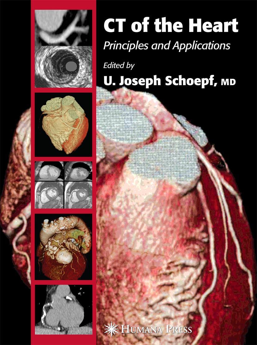 Vorderes Coverbild CT of the Heart