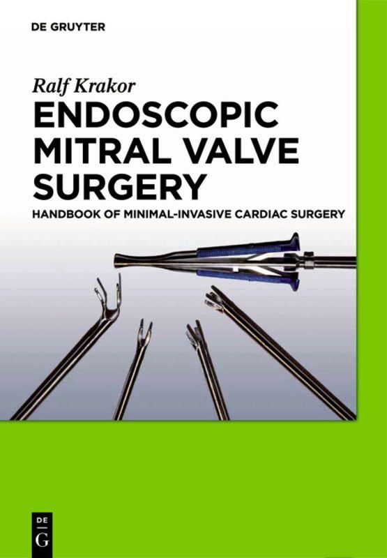 Vorderes Coverbild Endoscopic Mitral Valve Surgery