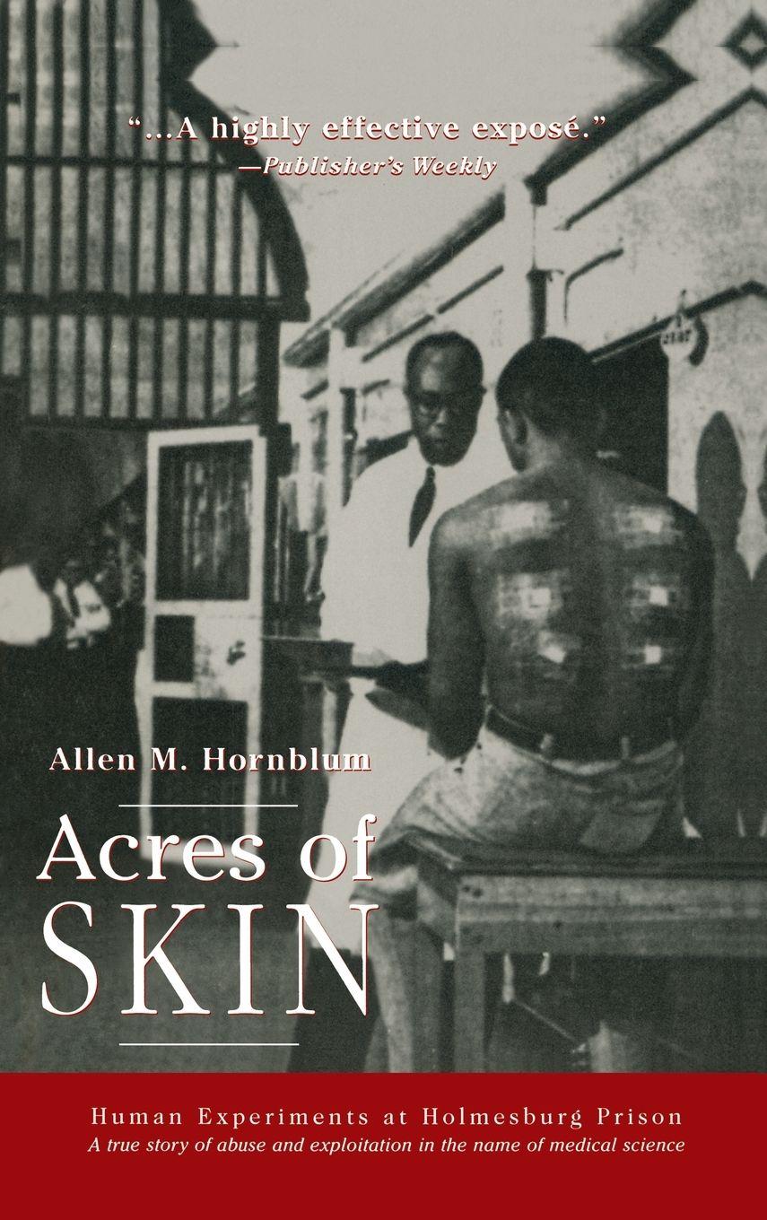Vorderes Coverbild Acres of Skin