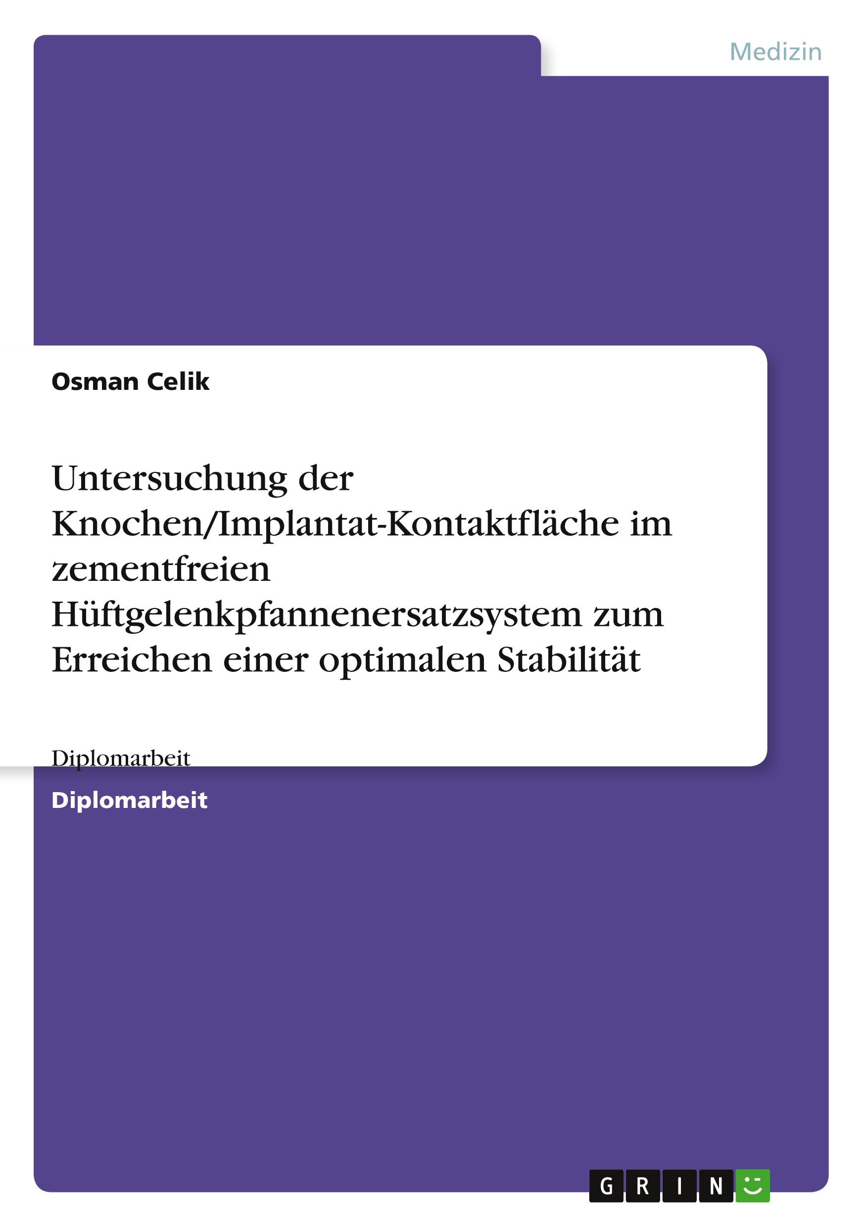 Vorderes Coverbild Untersuchung der Knochen/Implantat-Kontaktfläche im zementfreien Hüftgelenkpfannenersatzsystem zum Erreichen einer optimalen Stabilität