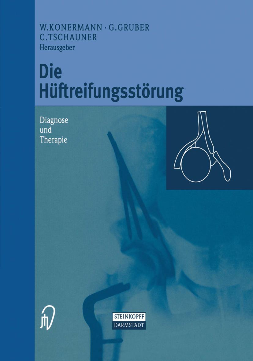 Vorderes Coverbild Die Hüftreifungsstörung