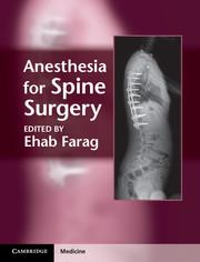 Vorderes Coverbild Anesthesia for Spine Surgery