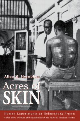 Vorderes Coverbild Acres of Skin
