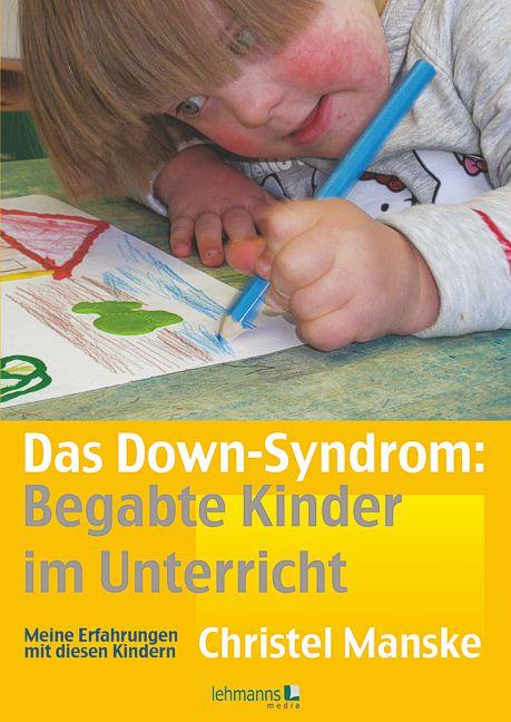 Vorderes Coverbild Das Down-Sydrom - Begabte Kinder im Unterricht