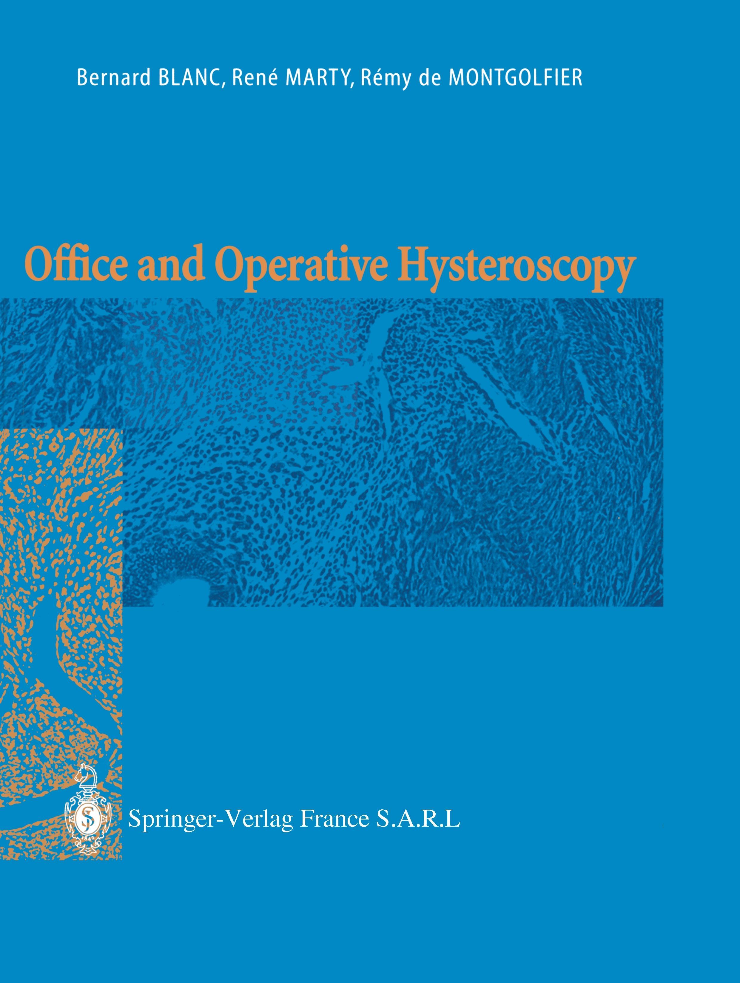 Vorderes Coverbild Office and Operative Hysteroscopy
