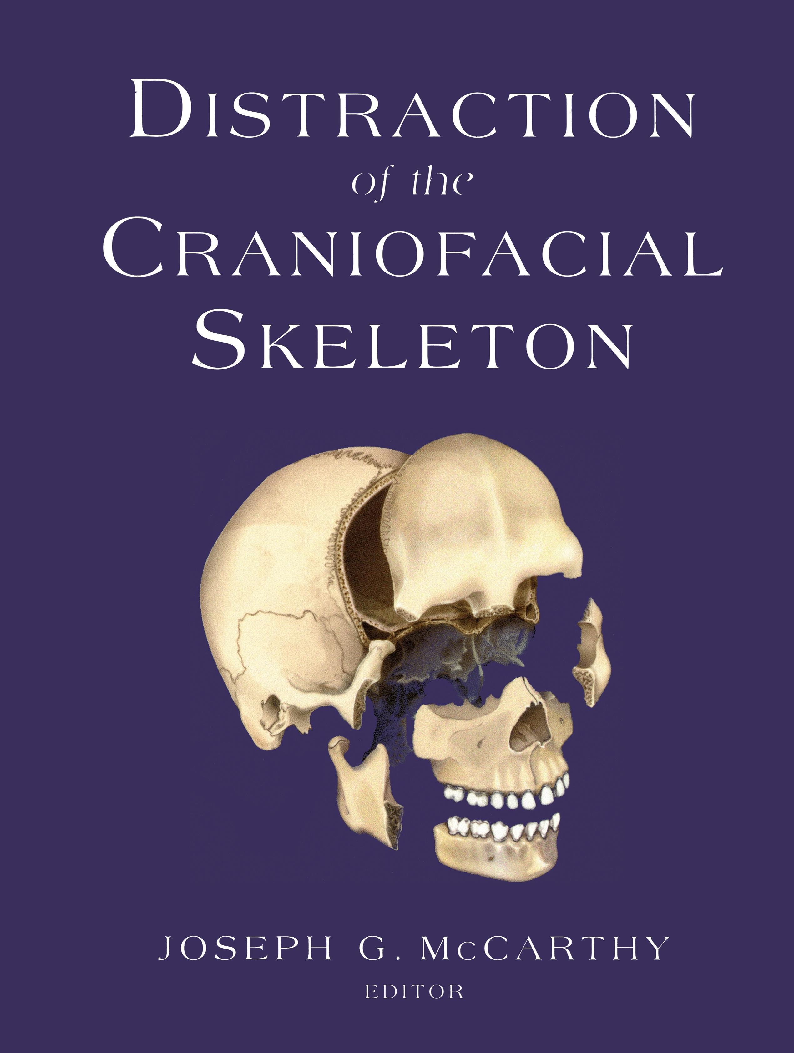 Vorderes Coverbild Distraction of the Craniofacial Skeleton