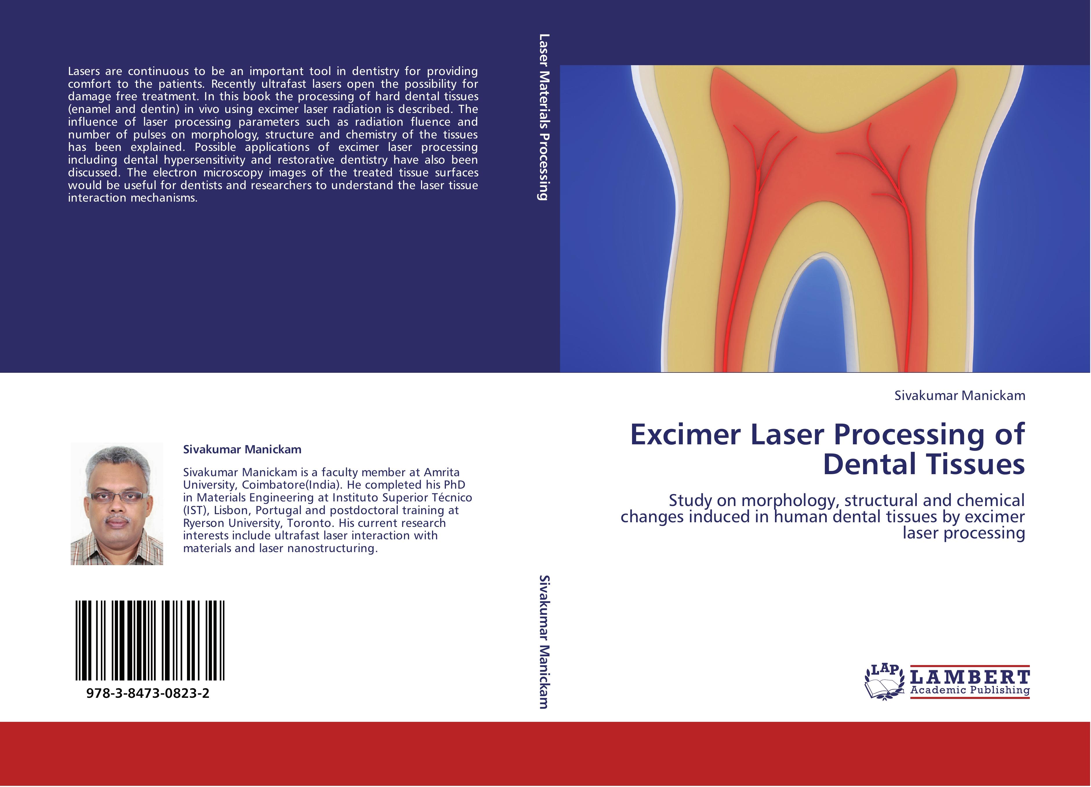 Vorderes Coverbild Excimer Laser Processing of Dental Tissues