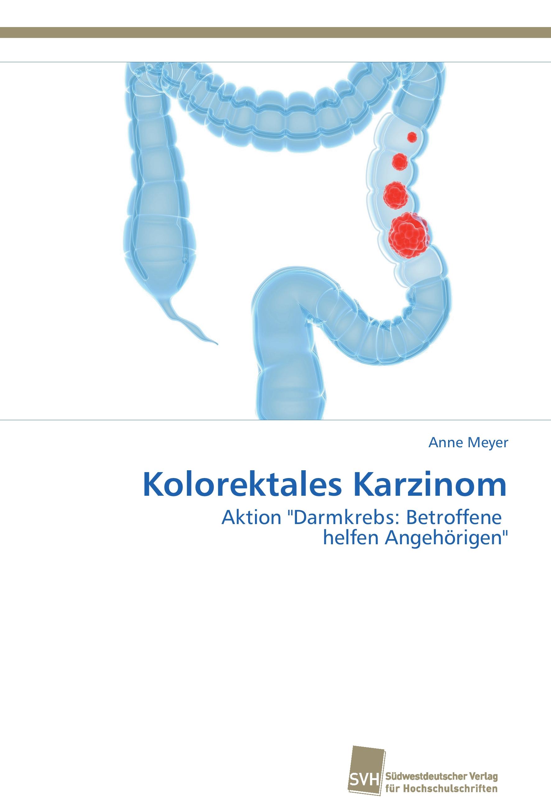 Vorderes Coverbild Kolorektales Karzinom