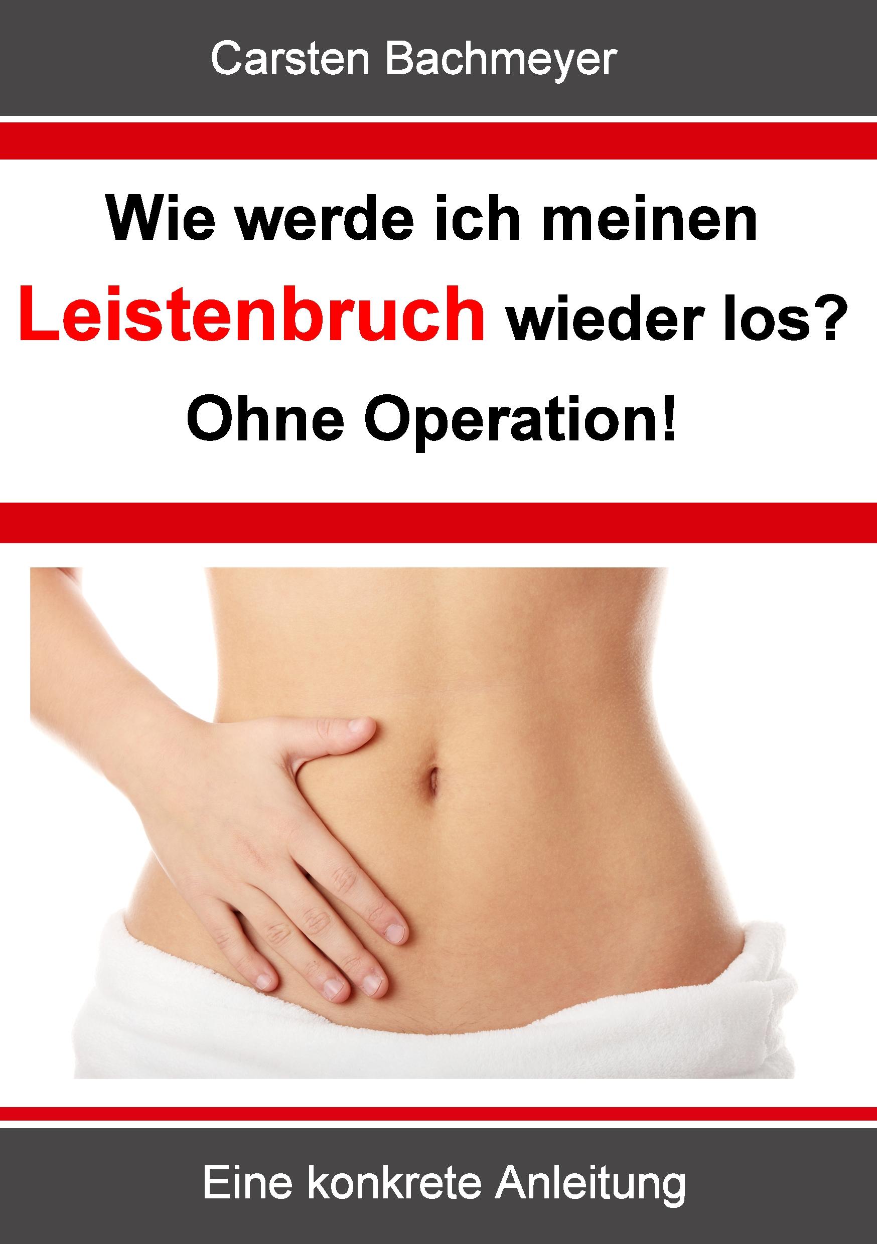 Vorderes Coverbild Wie werde ich meinen Leistenbruch wieder los?  Ohne Operation!