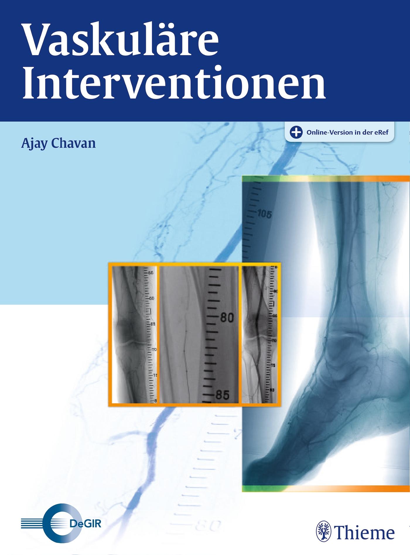Vorderes Coverbild Vaskuläre Interventionen