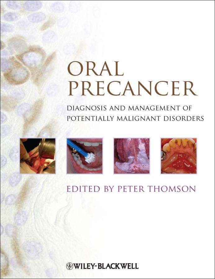 Vorderes Coverbild Oral Precancer