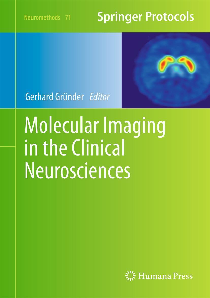 Vorderes Coverbild Molecular Imaging in the Clinical Neurosciences