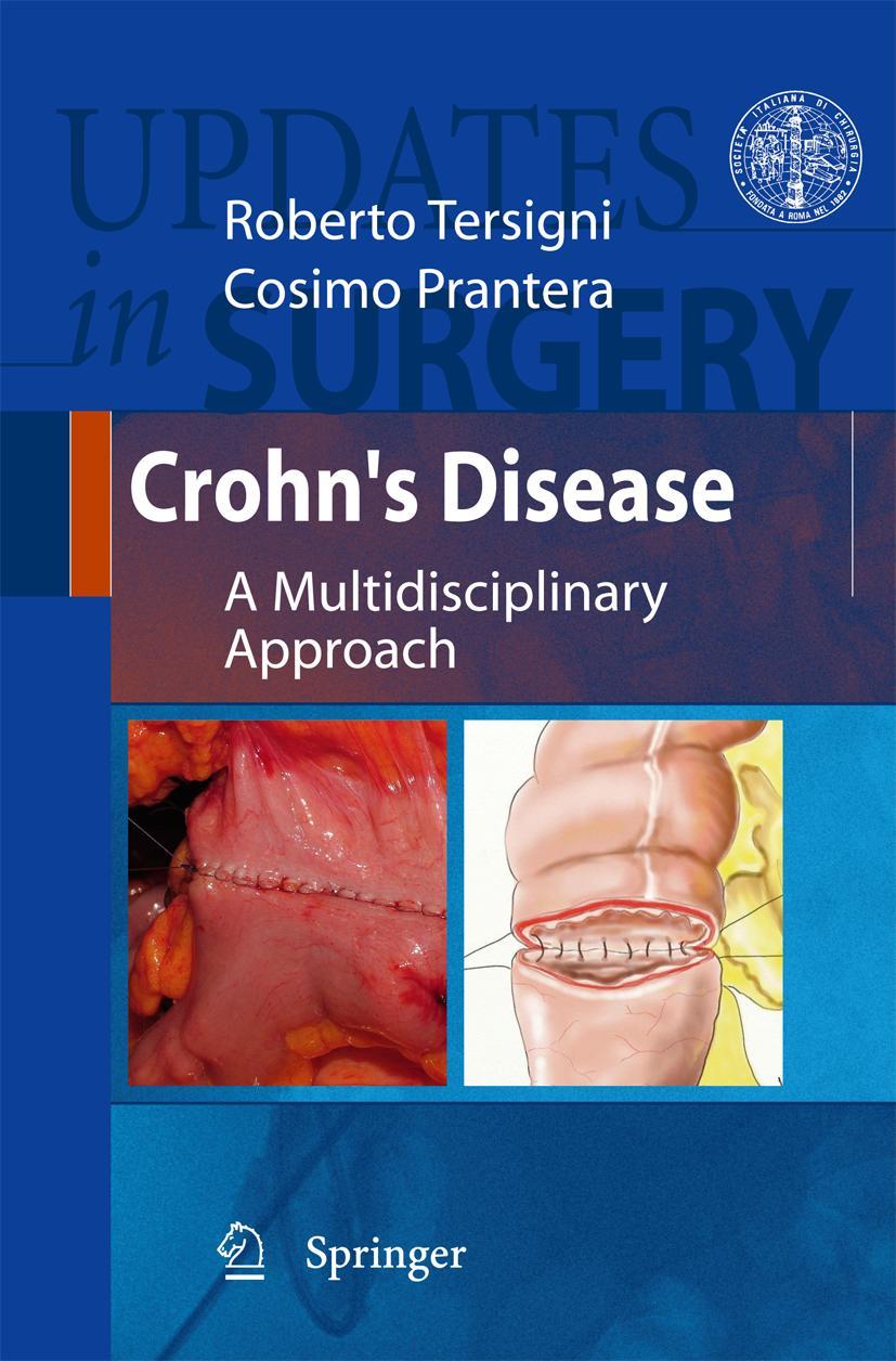 Vorderes Coverbild Crohn's Disease