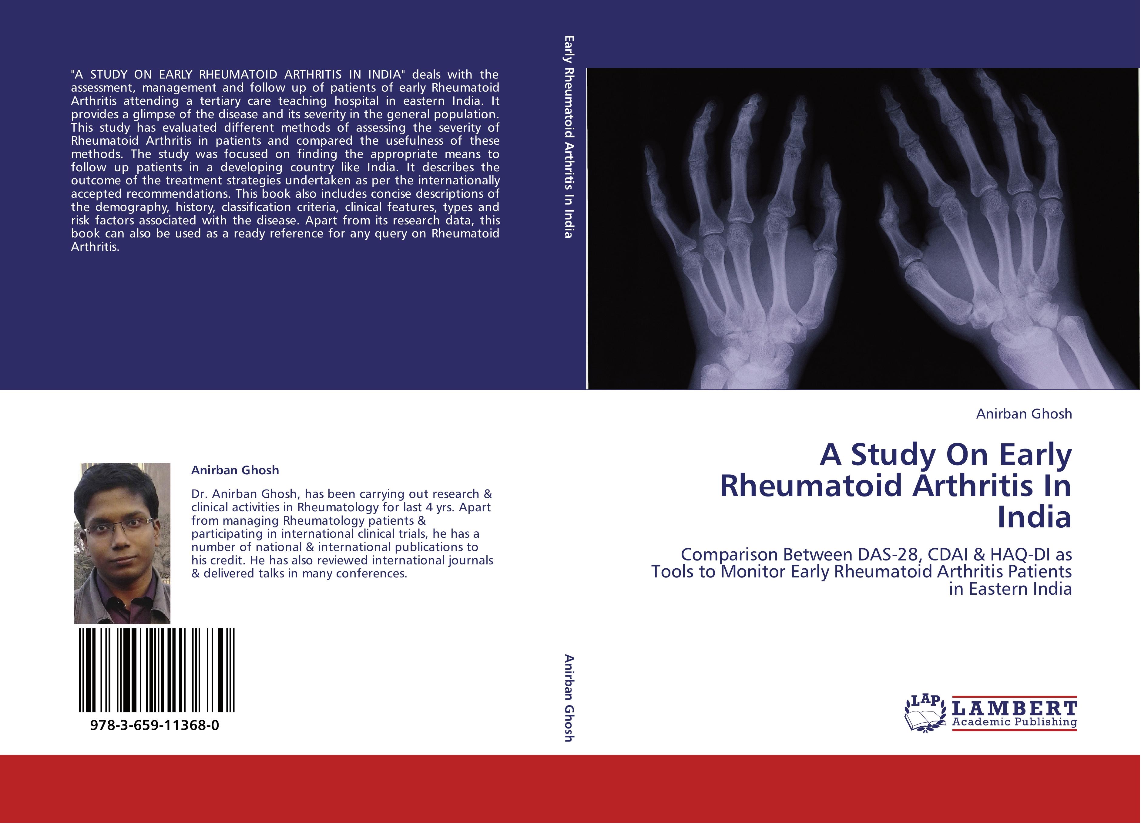 Vorderes Coverbild A Study On Early Rheumatoid Arthritis In India