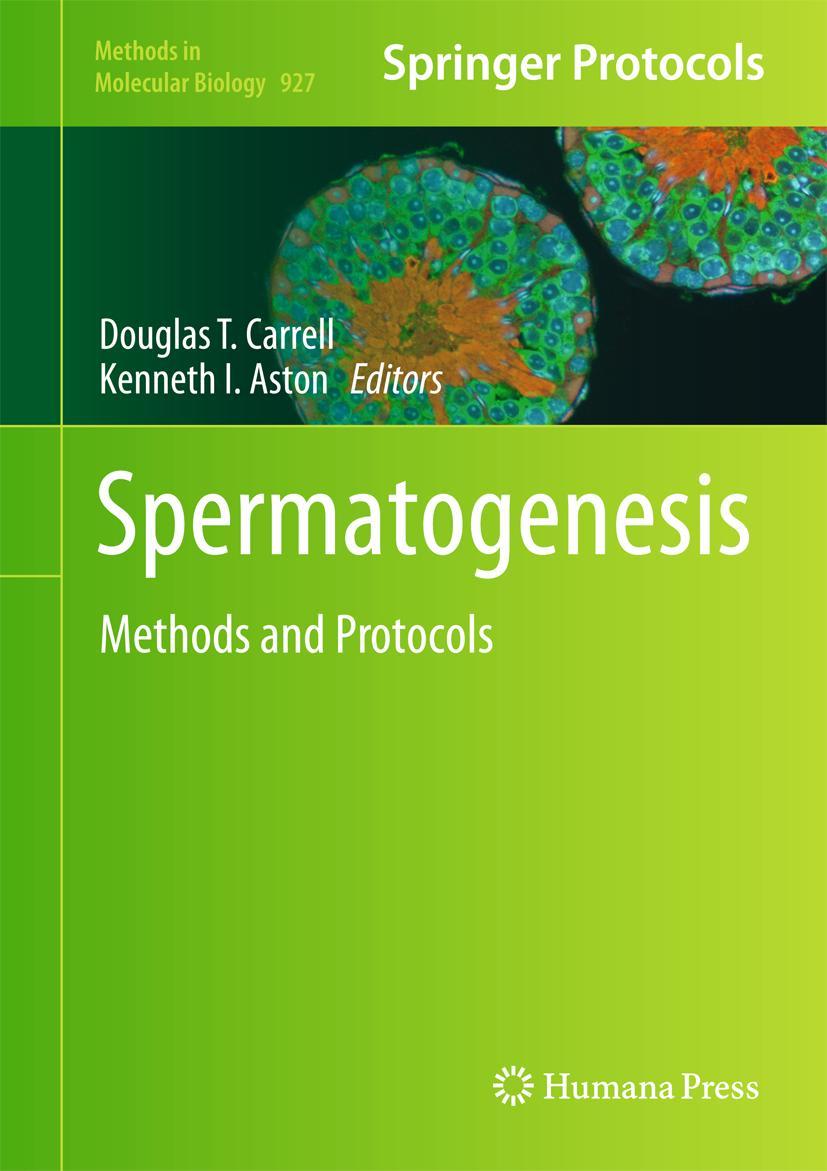 Vorderes Coverbild Spermatogenesis