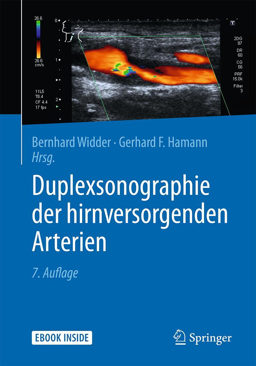 Vorderes Coverbild Duplexsonographie der hirnversorgenden Arterien