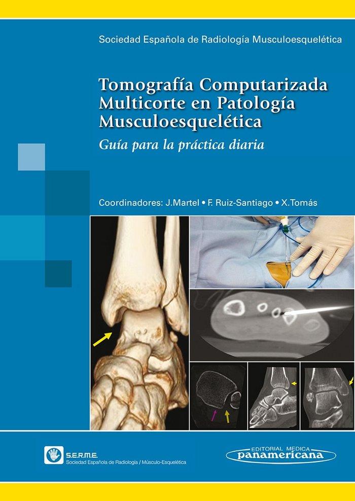 Vorderes Coverbild Tomografía computarizada multicorte en patología musculoesquelética : guía para la práctica diaria
