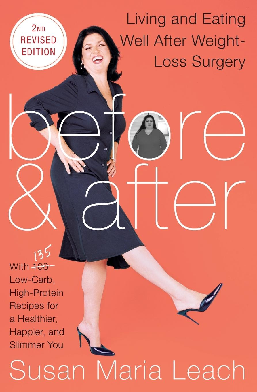 Vorderes Coverbild BEFORE & AFTER 2ND REV ED   PB