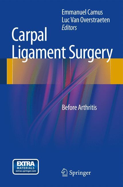 Vorderes Coverbild Carpal Ligament Surgery