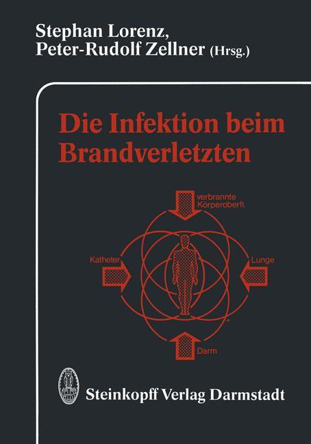 Vorderes Coverbild Die Infektion beim Brandverletzten