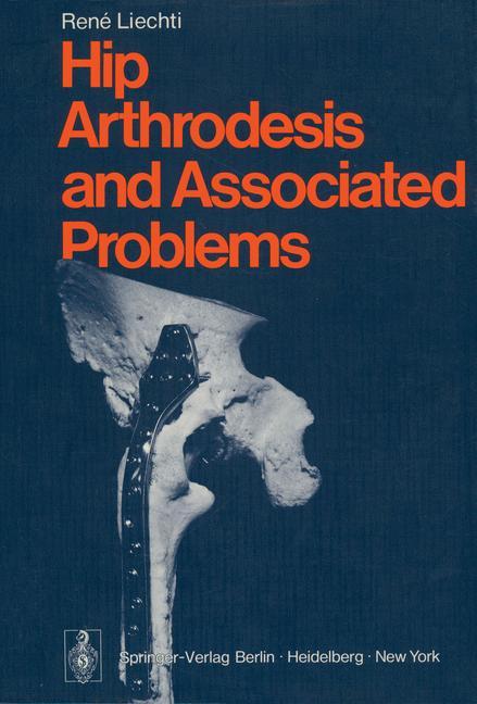 Vorderes Coverbild Hip Arthrodesis and Associated Problems