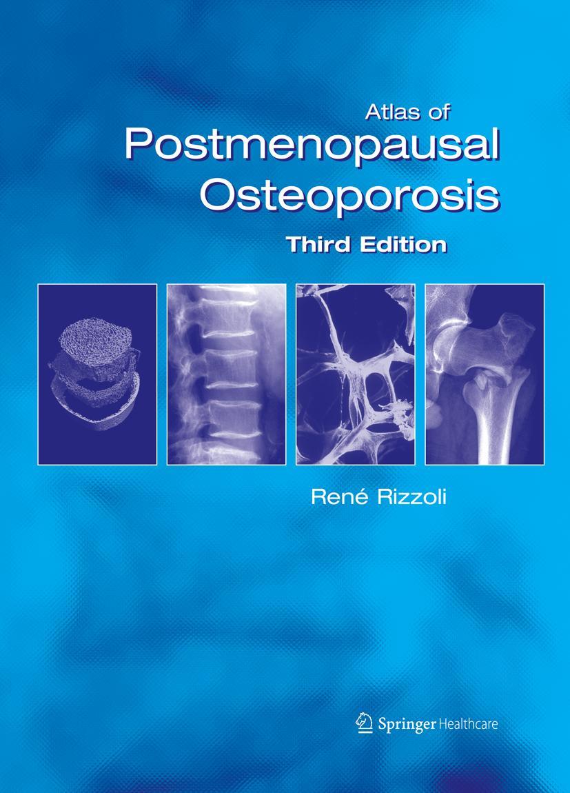 Vorderes Coverbild Atlas of Postmenopausal Osteoporosis