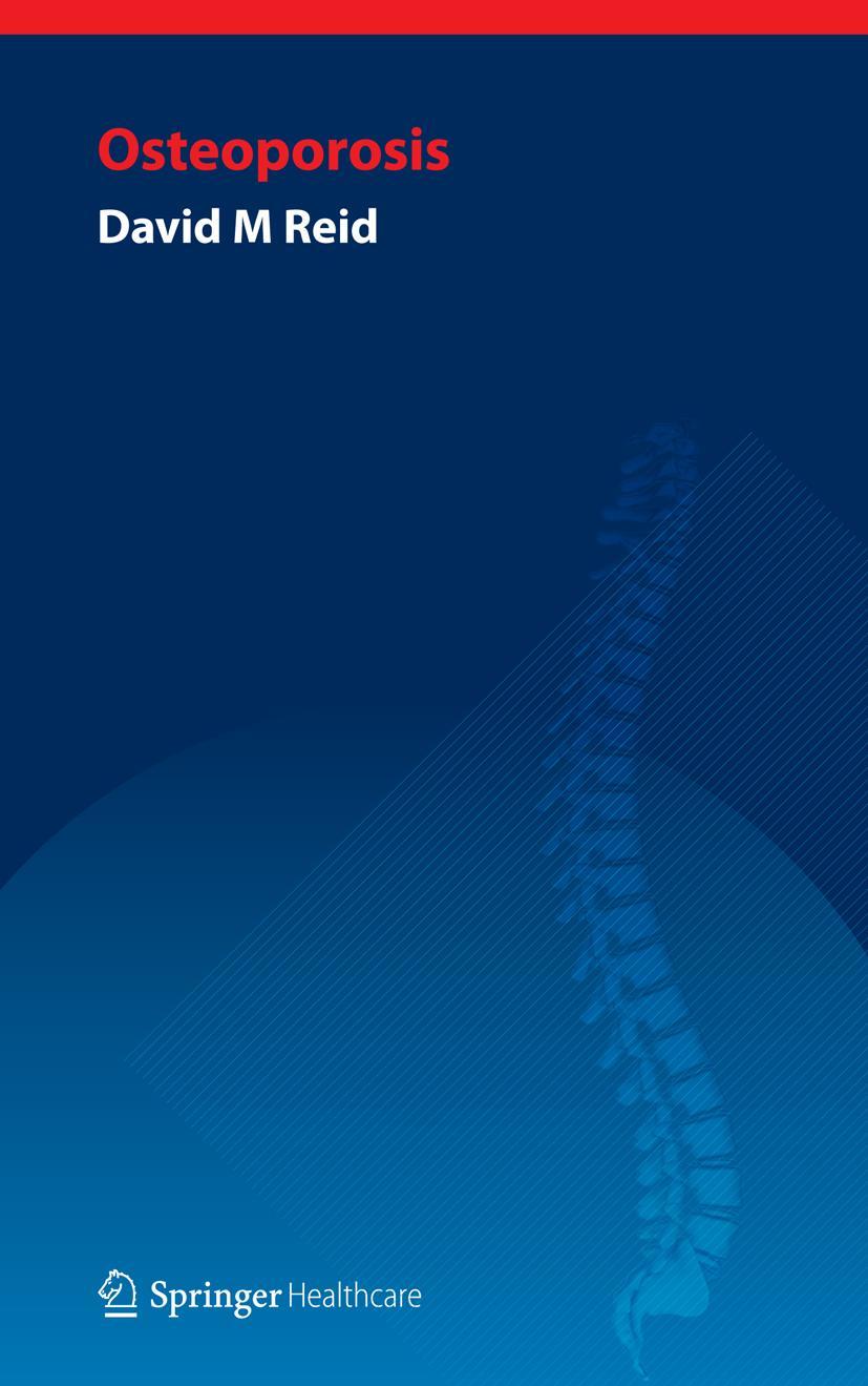 Vorderes Coverbild Handbook of Osteoporosis
