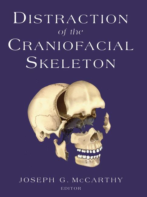 Vorderes Coverbild Distraction of the Craniofacial Skeleton