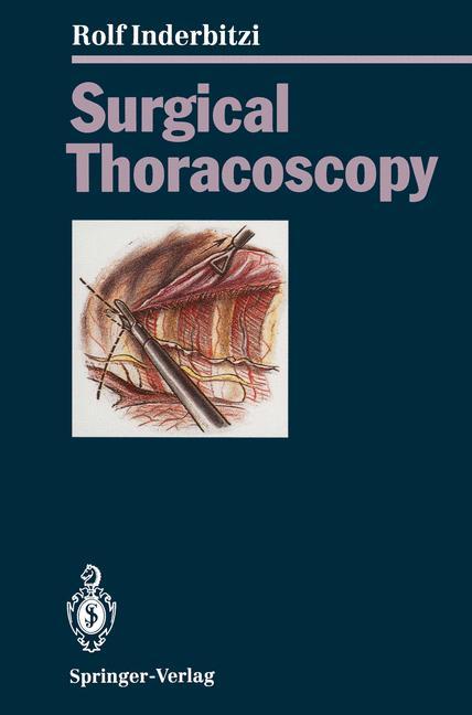 Vorderes Coverbild Surgical Thoracoscopy