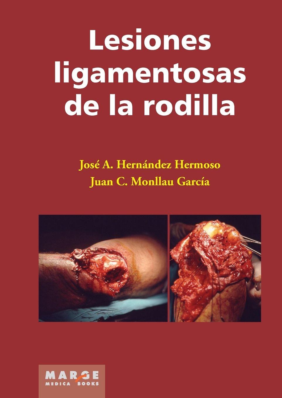 Vorderes Coverbild Lesiones ligamentosas de la rodilla