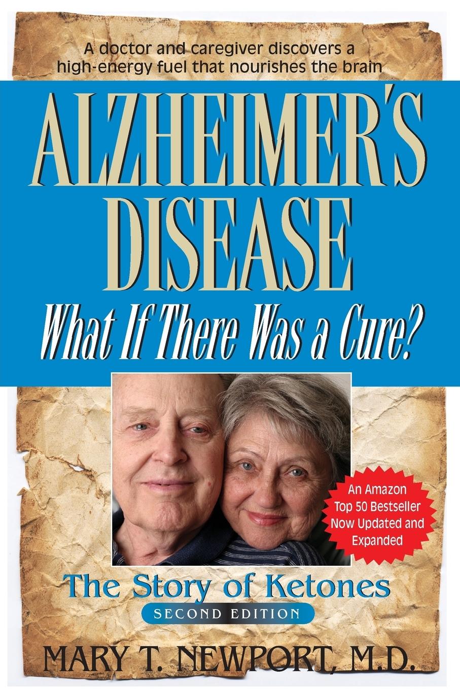 Vorderes Coverbild Alzheimer's Disease