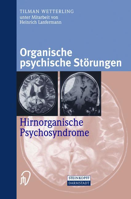 Vorderes Coverbild Organische psychische Störungen