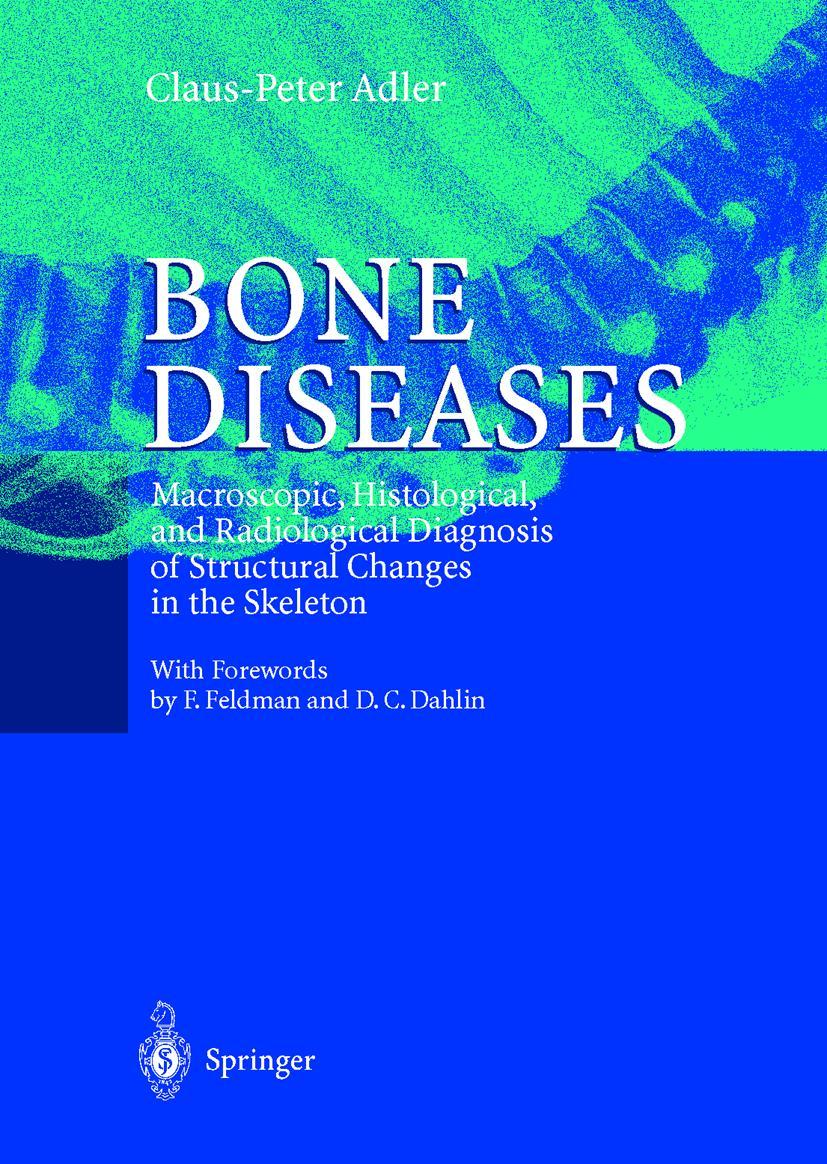 Vorderes Coverbild Bone Diseases