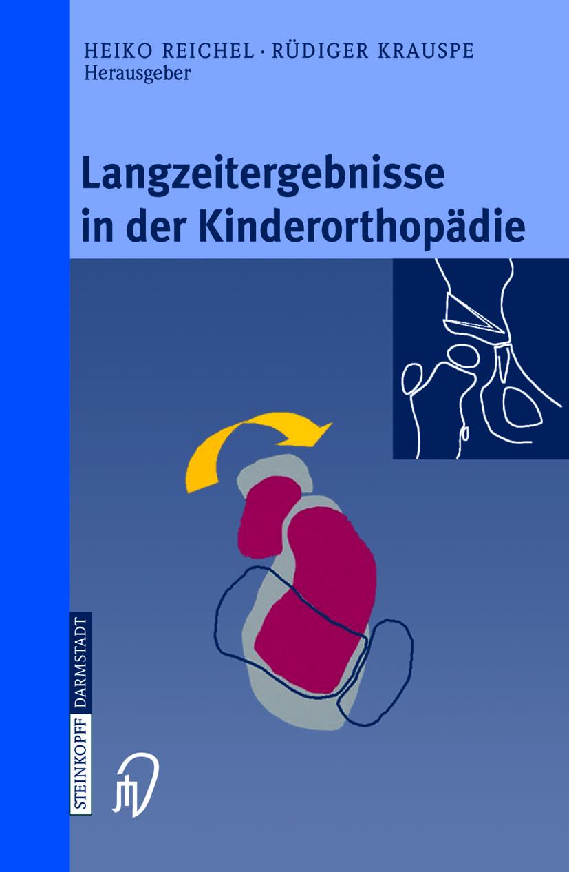 Vorderes Coverbild Langzeitergebnisse in der Kinderorthopädie
