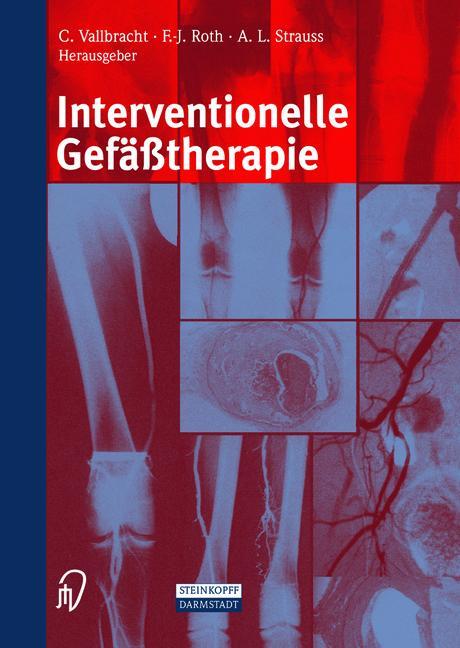 Vorderes Coverbild Interventionelle Gefäßtherapie