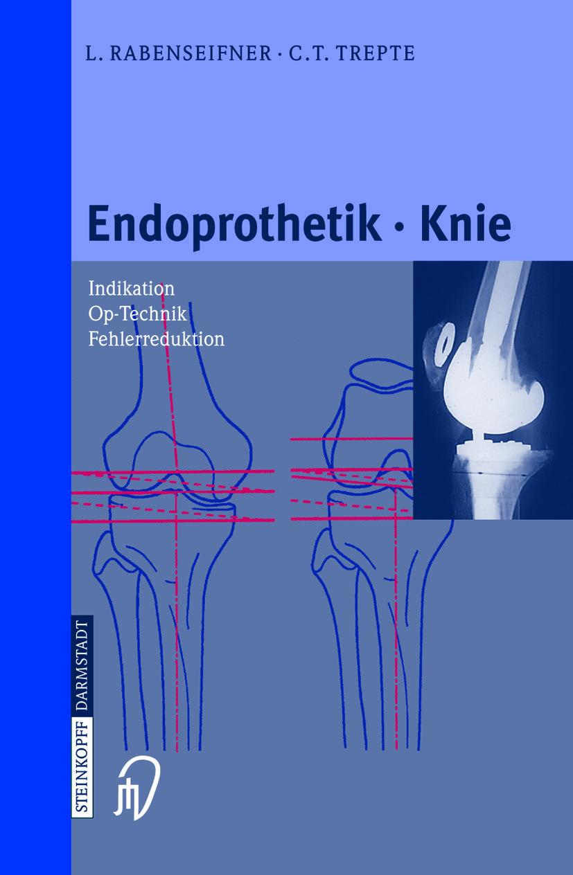 Vorderes Coverbild Endoprothetik Knie