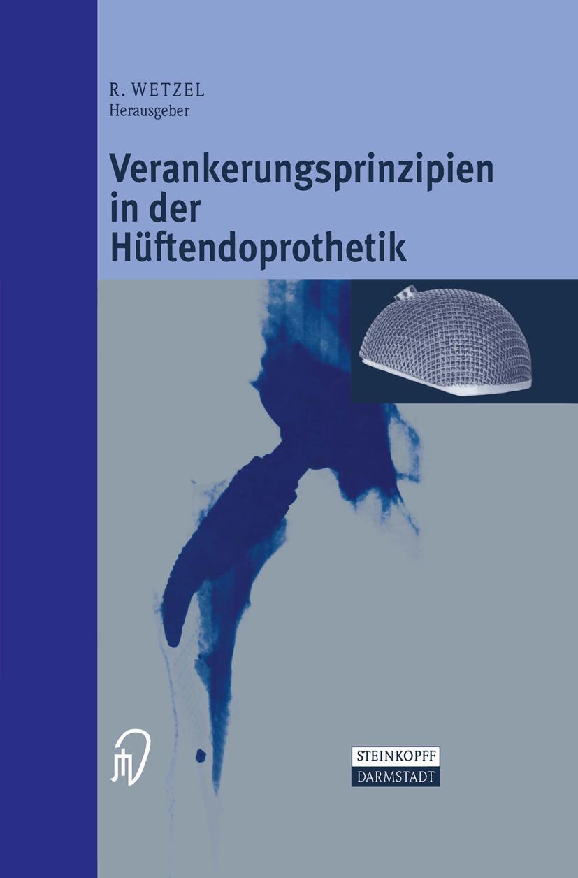 Vorderes Coverbild Verankerungsprinzipien in der Hüftendoprothetik